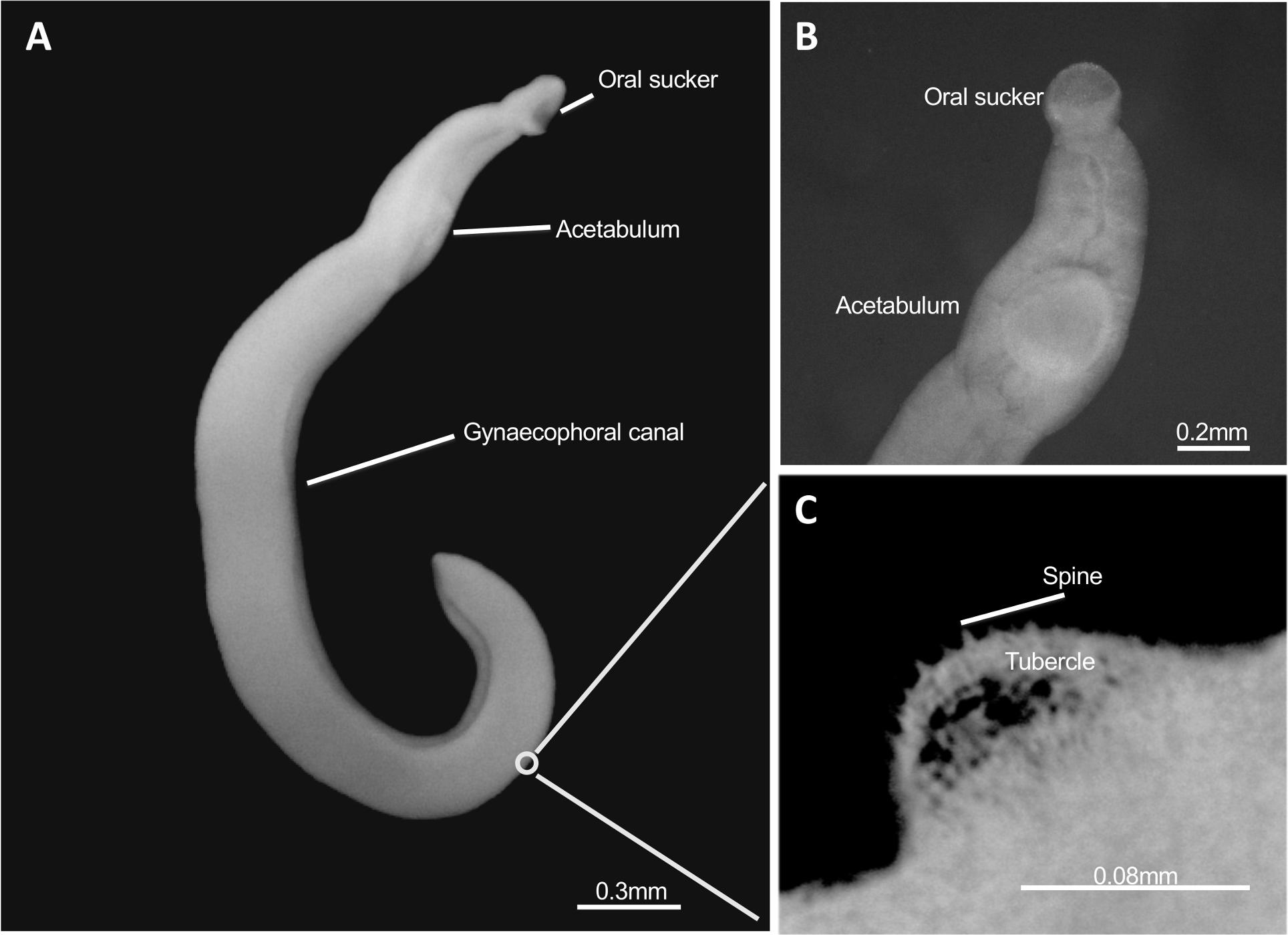 schistosoma haematobium rash